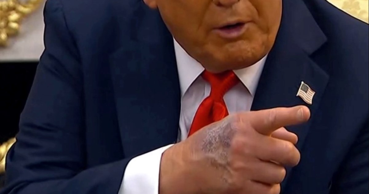 Internet gori: Uveliko se špekulira da je Trump umro