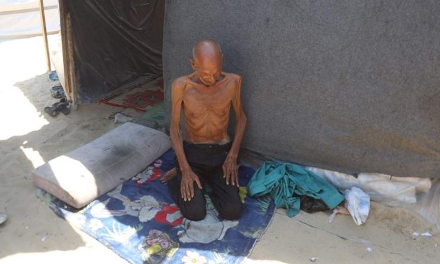 Mujezin iz Gaze od gladi više ne može ni da stoji na nogama