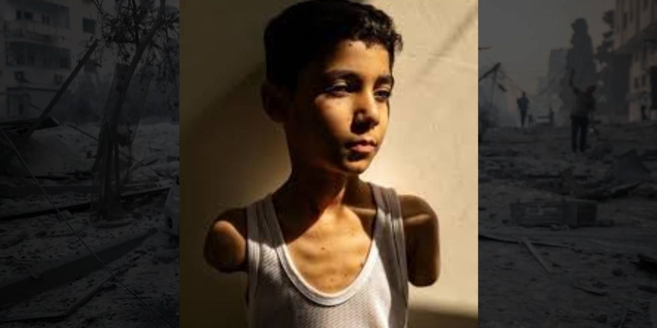 Kada je ostao bez ruku prvo što je mali Mahmoud pitao majku bilo je: “Kako ću te sada zagrliti”