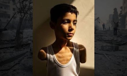 Kada je ostao bez ruku prvo što je mali Mahmoud pitao majku bilo je: “Kako ću te sada zagrliti”