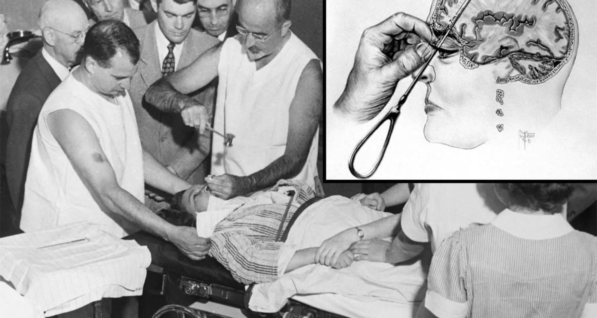 Lobotomija: Zastrašujući tretman nagrađen Nobelovom nagradom