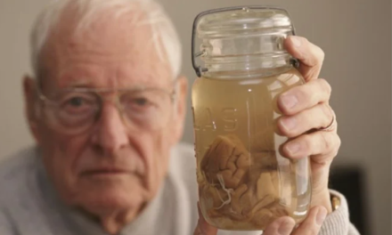 Šta nam zapravo govori mozak Albert Einsteina