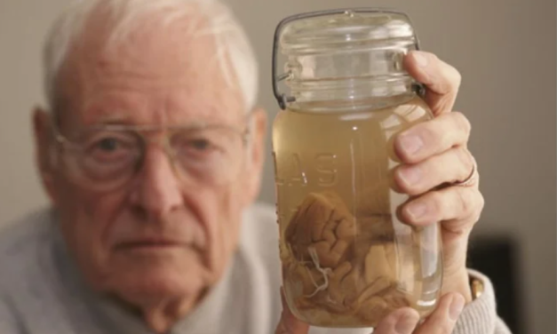 Šta nam zapravo govori mozak Albert Einsteina